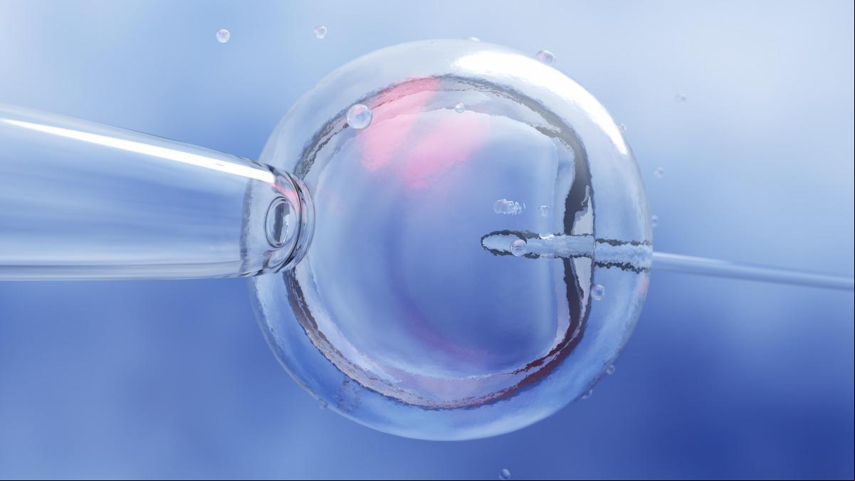 Un padre divorciado con cuatro hijos se somete a una vasectomía, busca otro bebé in vitro con su nueva pareja y termina con mellizas