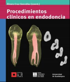 Procedimientos Clínicos En Endodoncia (ebook)